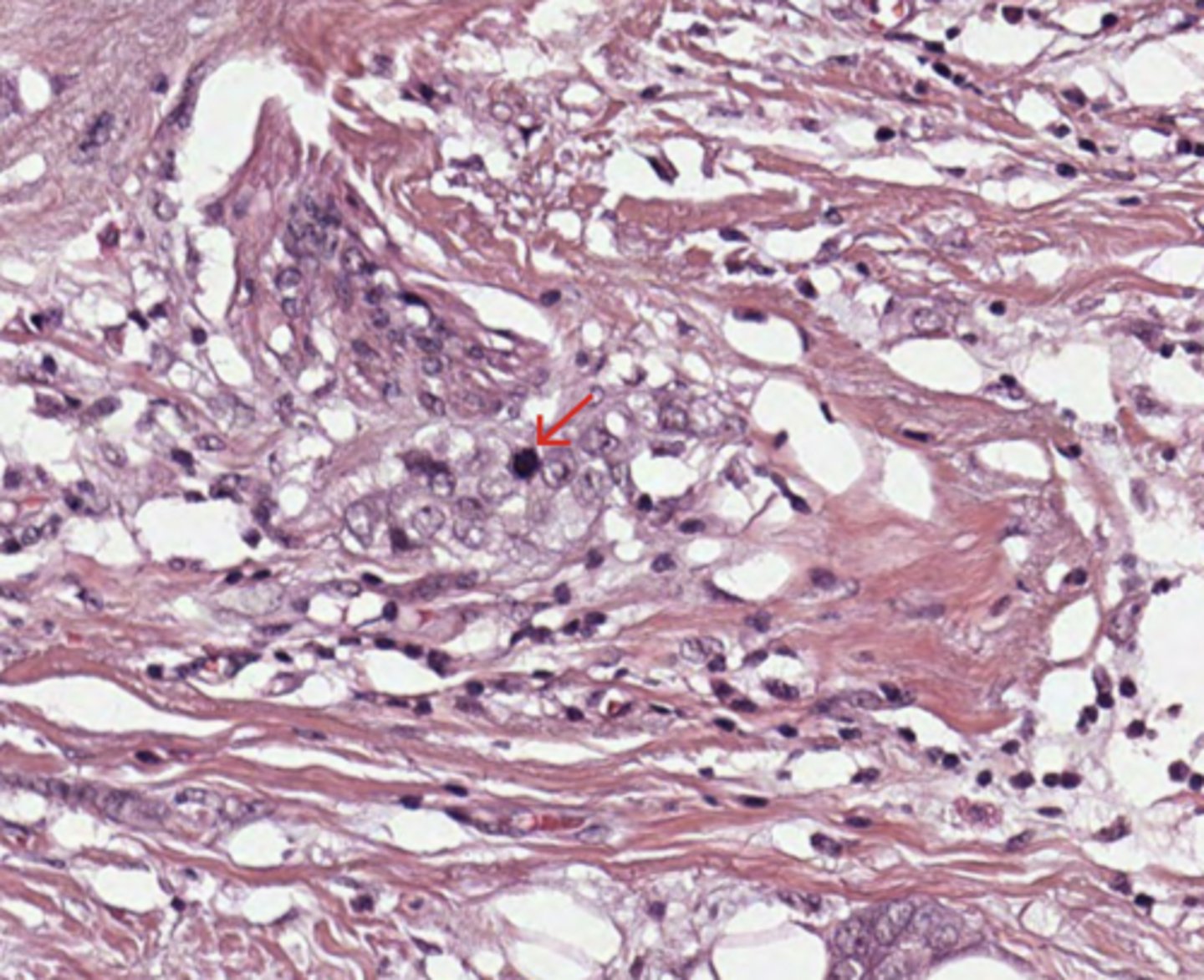 <p>Breast</p>