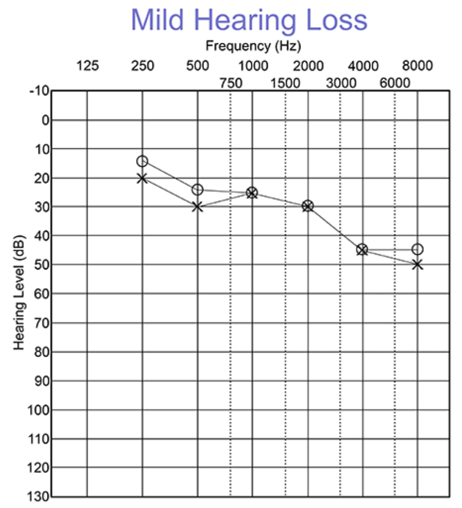 <p>graph displaying hearing sensitivity </p><ul><li><p>inverted scale: </p><ul><li><p>vertical axis (dB HL) (lower dB # at top; higher dB # at bottom) </p></li><li><p>horizontal axis (frequencies Hz) (low frequencies on left; high frequencies on right) </p></li></ul></li></ul><p></p>