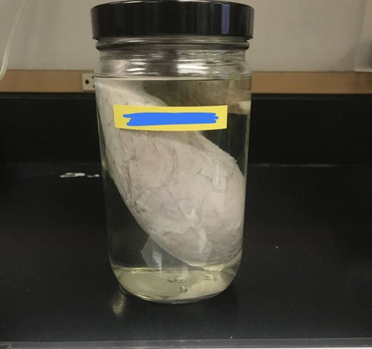 <p>For the following specimen, give the following:</p><p>1) name</p>