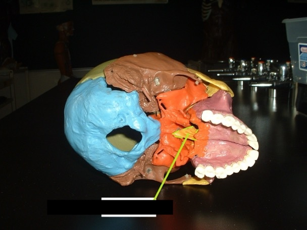 <p>a flat triangular bone that divides the nose; the point of the Vomer sticks out of the lower jaw; If removed looks like a Dorito. </p>