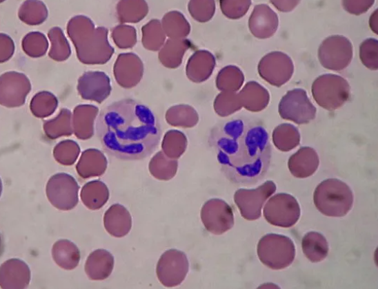 <p>Identify the leukocyte</p>