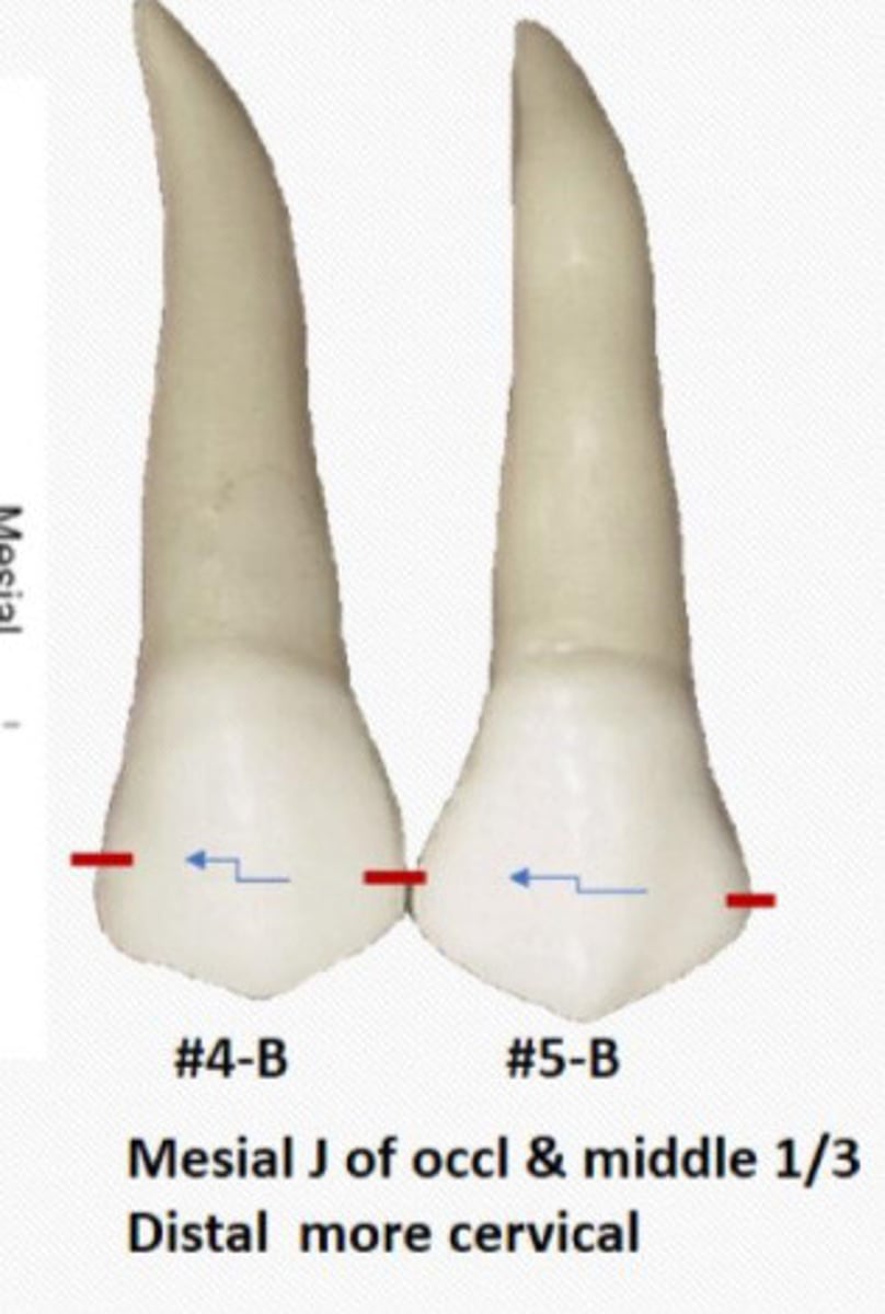 <p>__ contact is In middle third</p><p>Is more cervical than mesial</p>