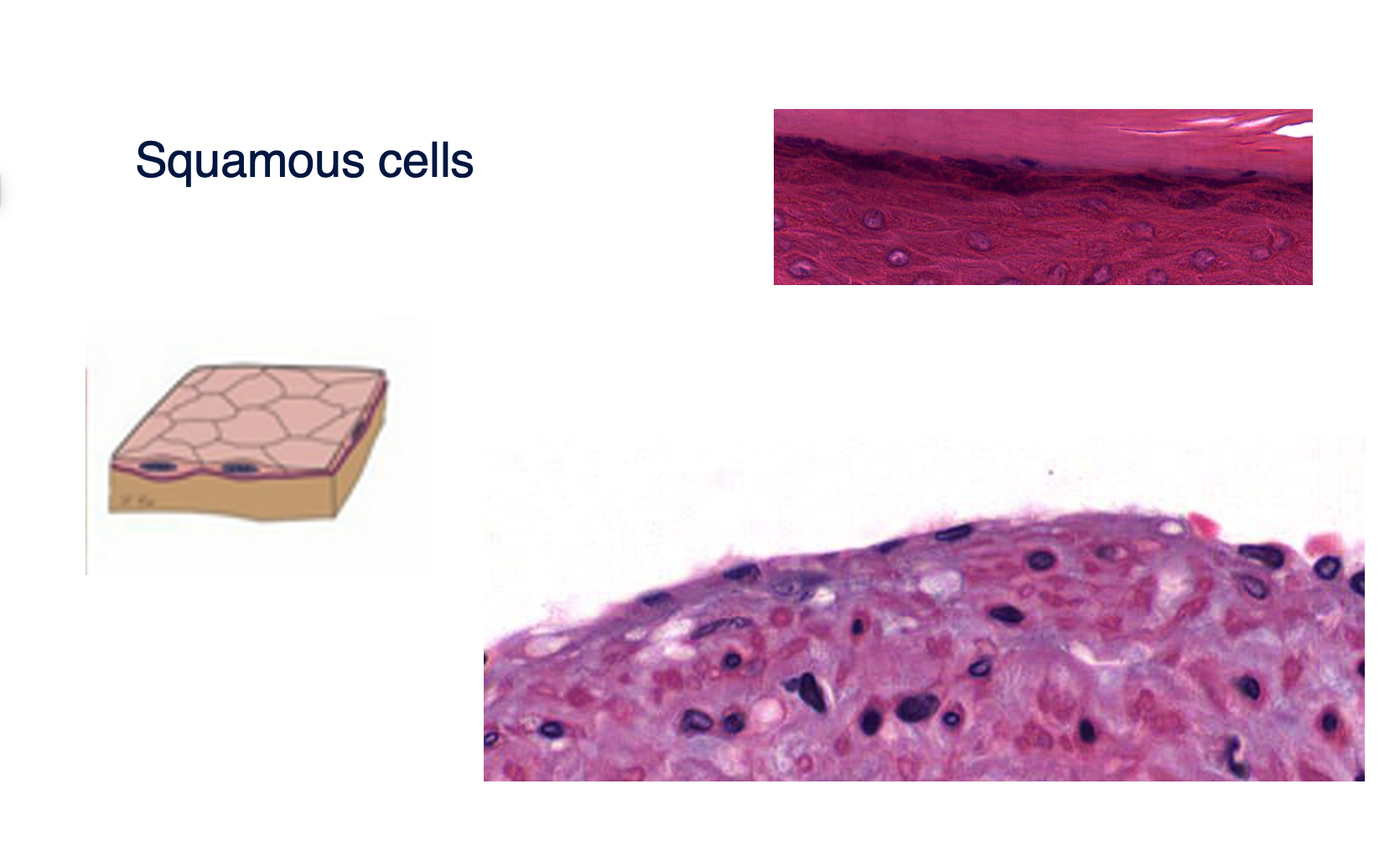 <p>Squamous cells</p>
