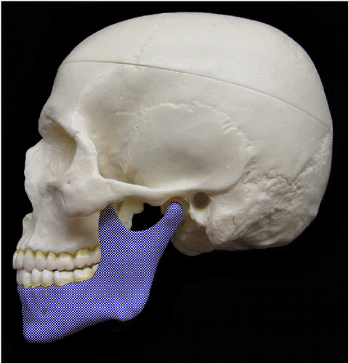 <p>lower jaw bone, only bone of the skull not joined by sutures</p>