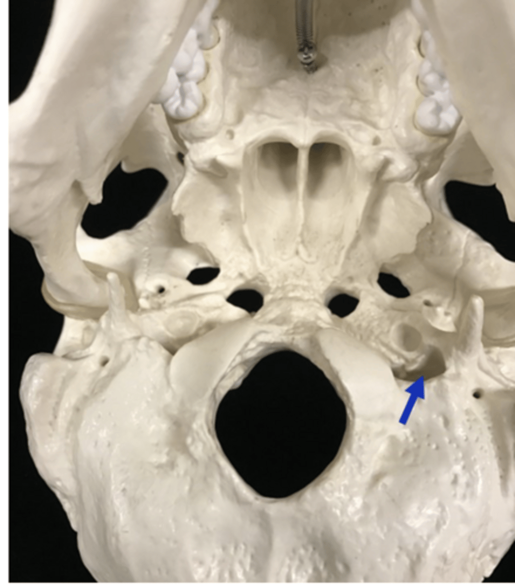 <p>name the bone and bone feature</p>