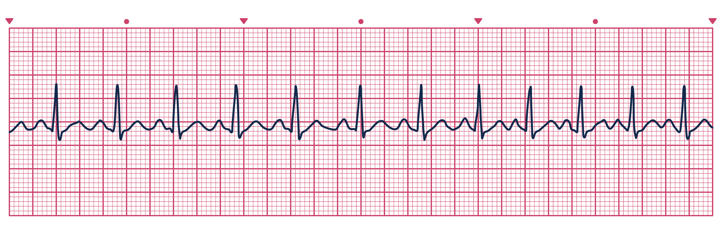 <p>&gt;100 bpm</p>