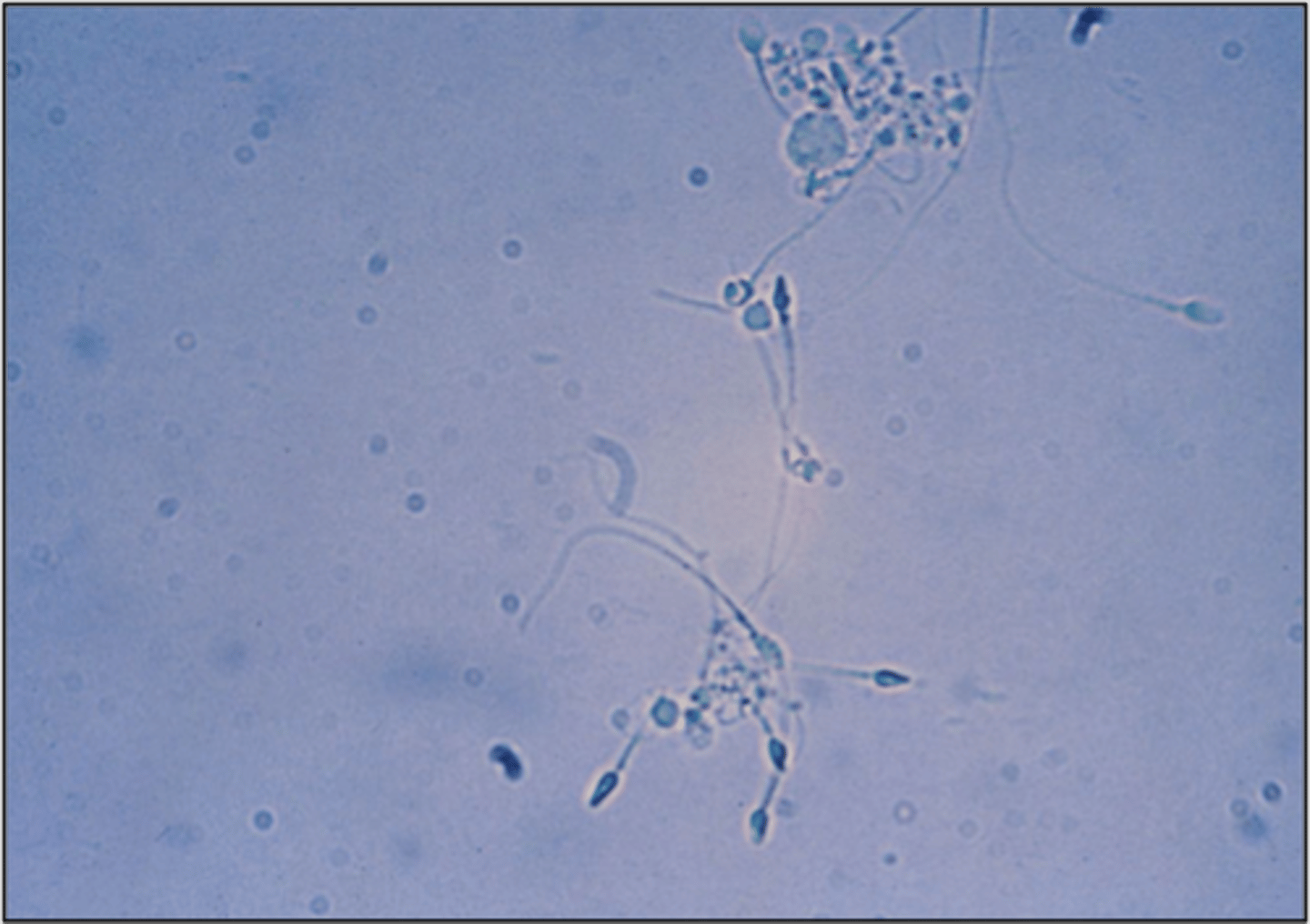 <p>Tapered oval head with long thing tail</p><p>-reported as= present</p><p>-correlations= protein</p>