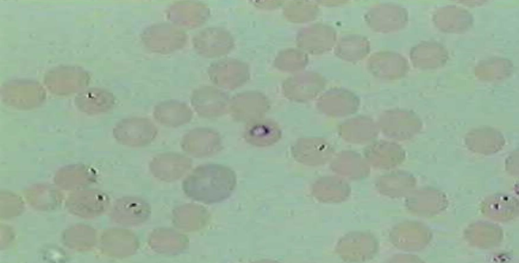 <p>What is the name of this microbe?</p>