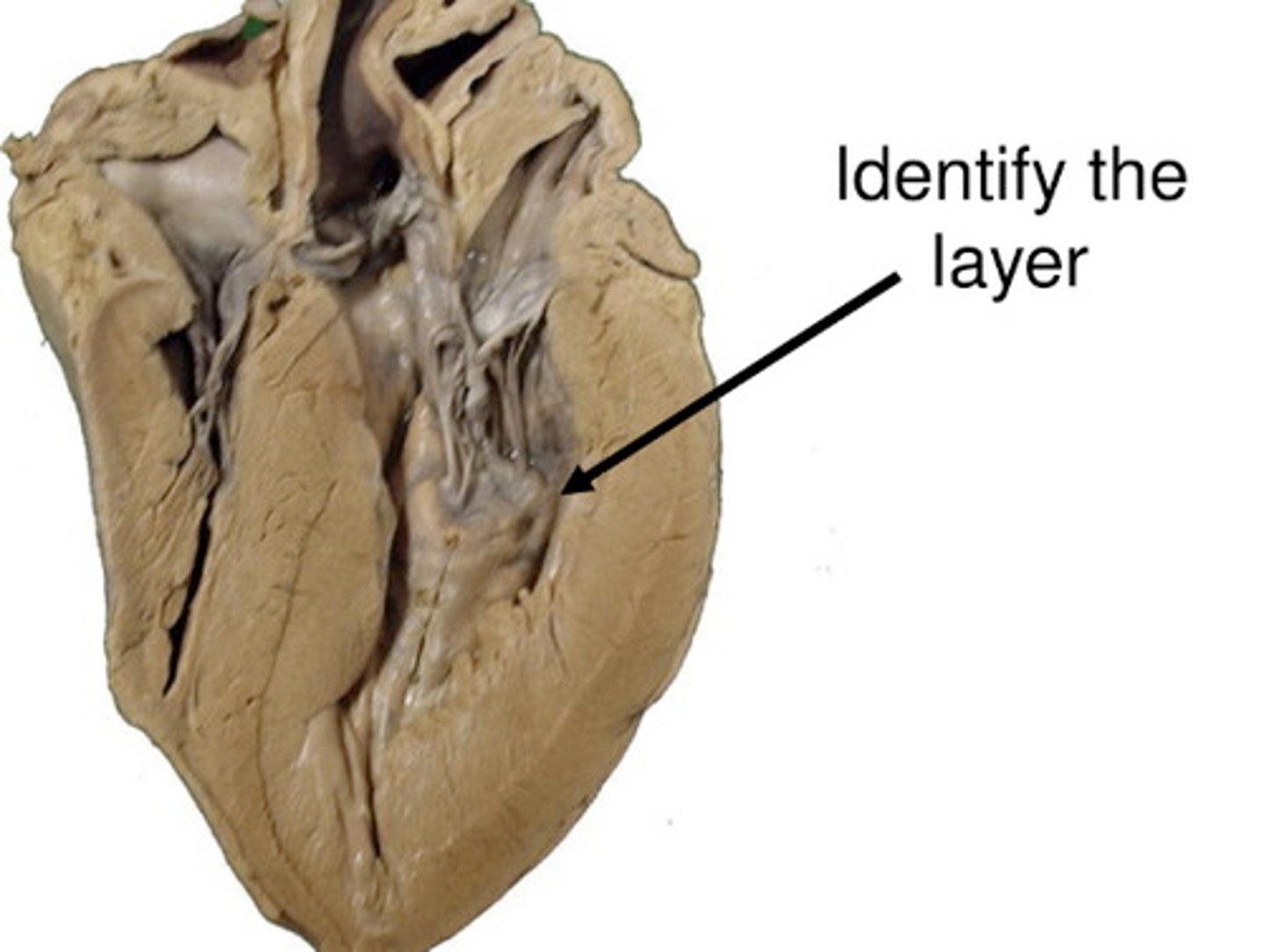 <p>continuous with endothelium of blood vessels, smooth inner lining of heart chambers; covers valves</p>