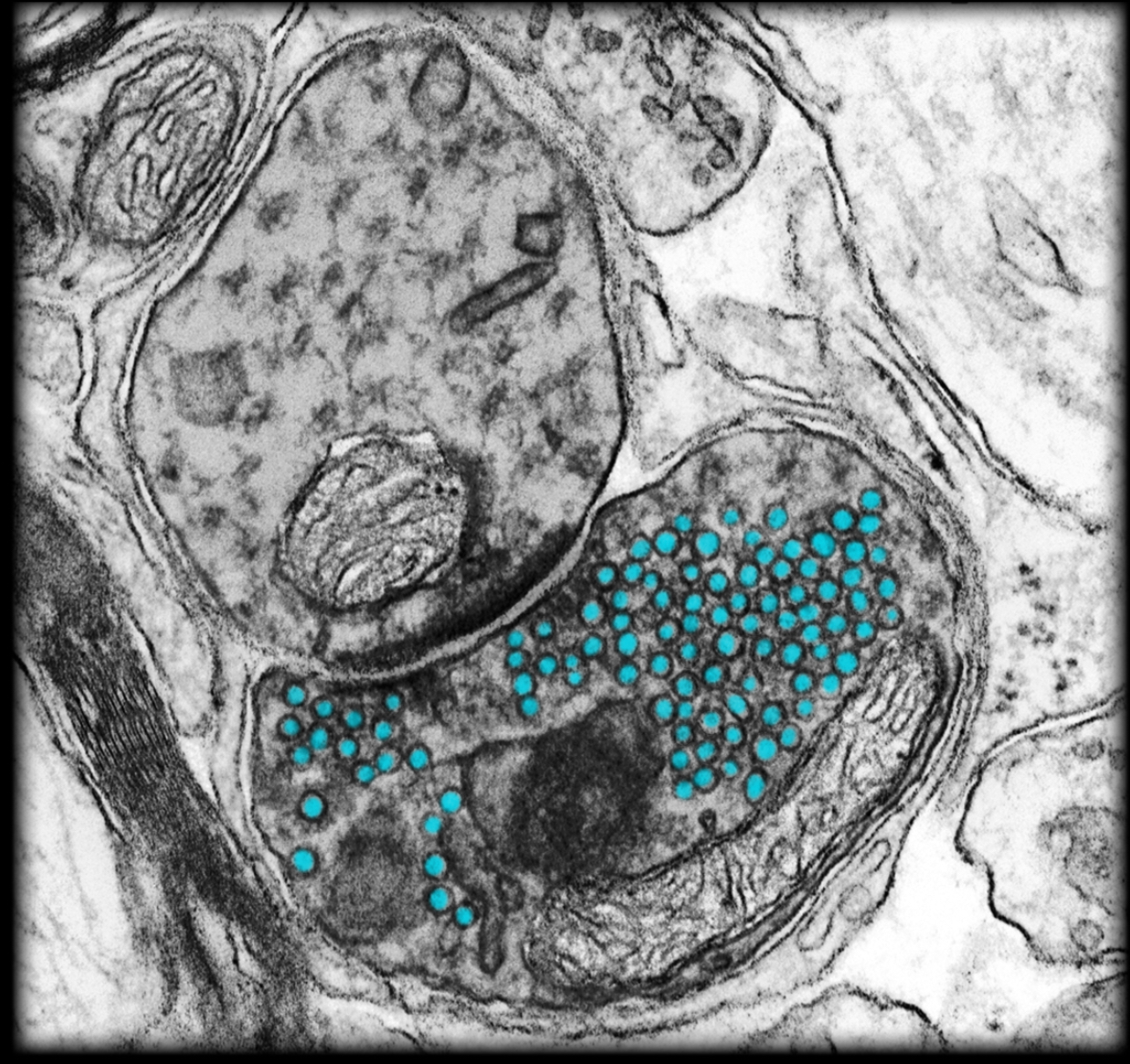 <h4 collapsed="false" seolevelmigrated="true"><strong>Location:</strong></h4><ul><li><p>Presynaptic terminal</p></li></ul><h4 collapsed="false" seolevelmigrated="true"><strong>Description:</strong></h4><ul><li><p>Membrane-bound organelle</p></li><li><p>Small sac containing neurotransmitters</p></li></ul><h4 collapsed="false" seolevelmigrated="true"><strong>Function:</strong></h4><ul><li><p>Storage and release of neurotransmitters</p></li></ul><h4 collapsed="false" seolevelmigrated="true"><strong>Comment:</strong></h4><ul><li><p>Neurotransmitters are chemical agents (e.g., acetylcholine, norepinephrine) released by presynaptic cell at chemical synapse</p></li></ul>