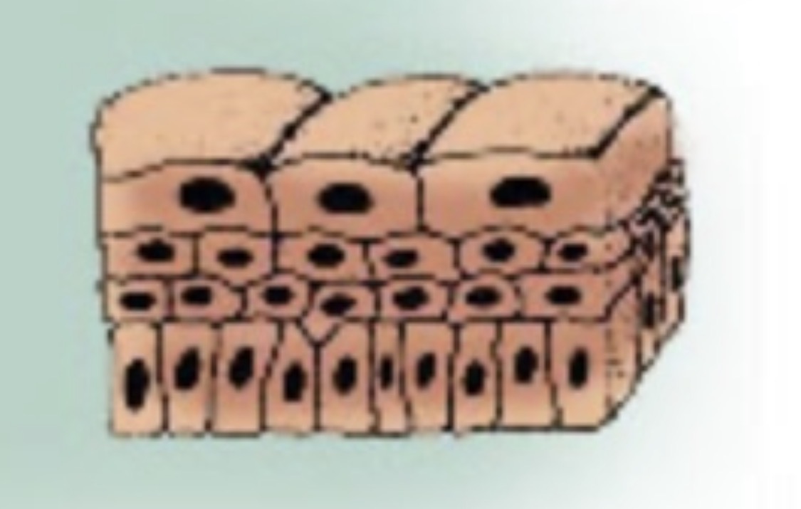 <p>What type of epithelium is this?</p>