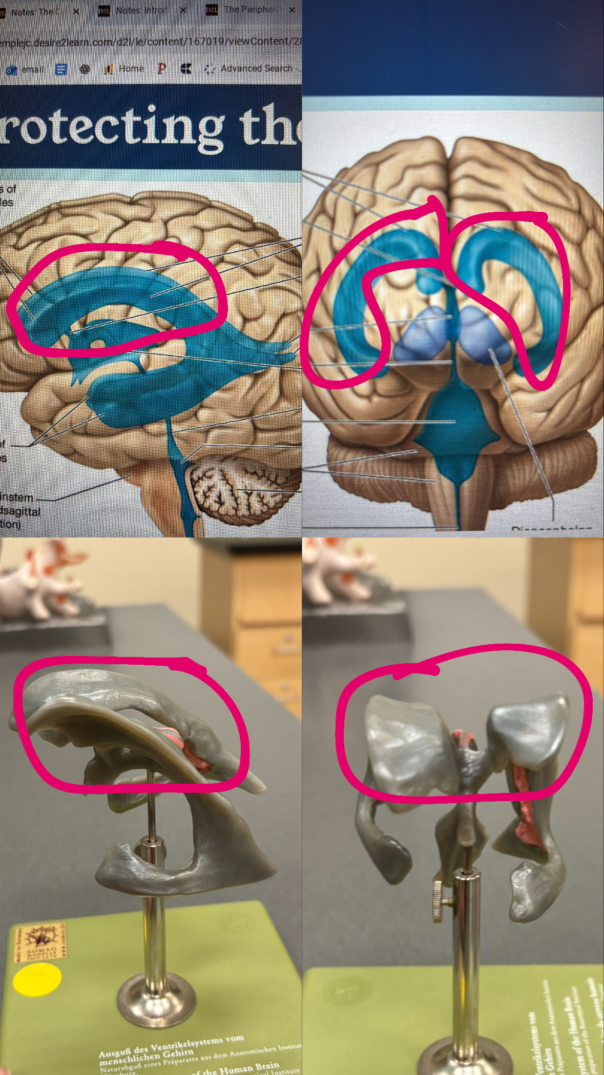 <p>lateral ventricles</p>