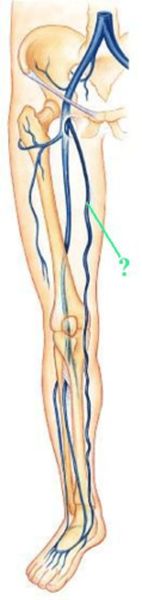 <p>Identify the indicated blood vessel.</p>