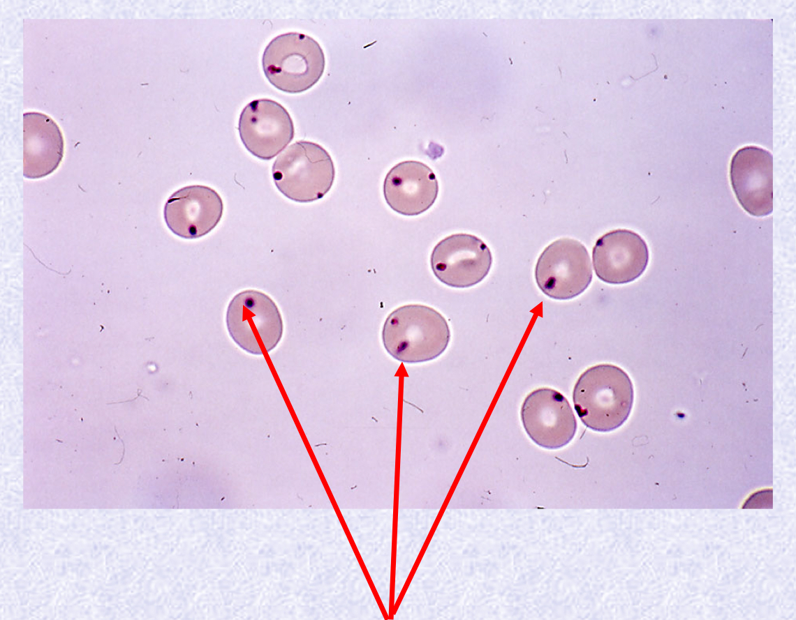 <p>What cell type &amp; stain type is in the image?</p>