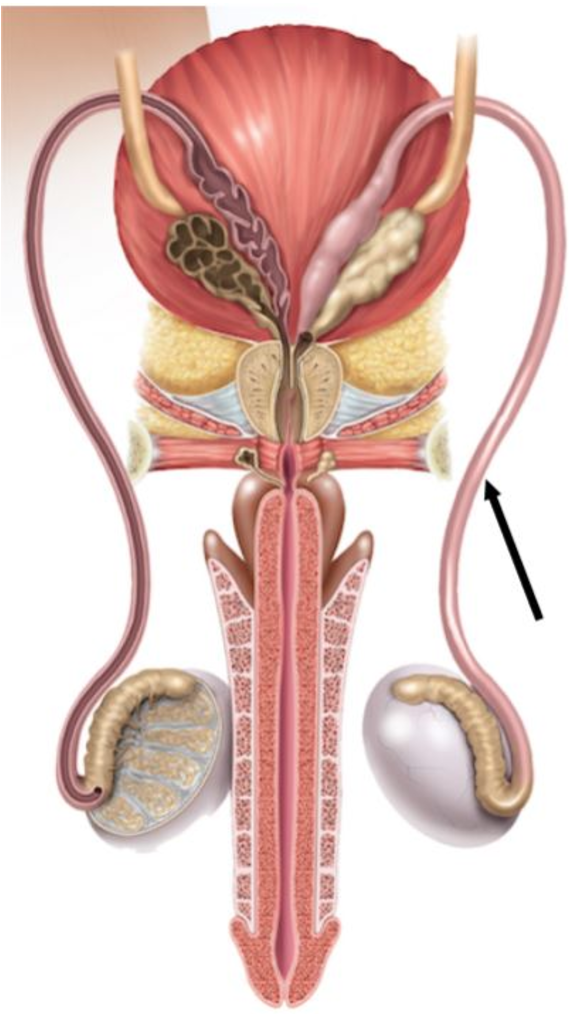 <p><span>The ______ deferens is indicated in the figure.</span></p>