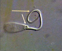 <p>Identify the sperm morphology.</p>