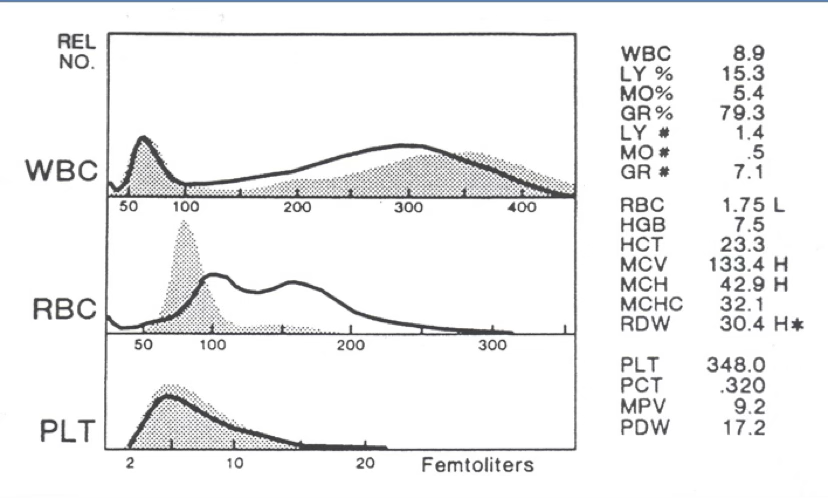 <p>what are the 2 most probable causes of a bi-modal RBC histogram?</p>