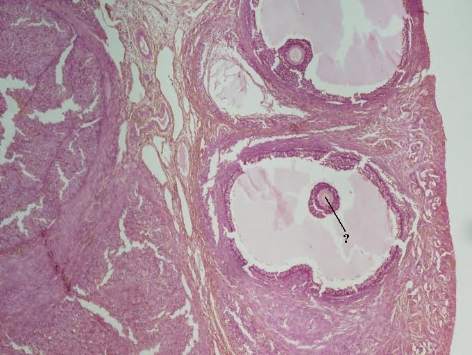<p><span><span>Identify the indicated structure within the ovary.</span></span></p>
