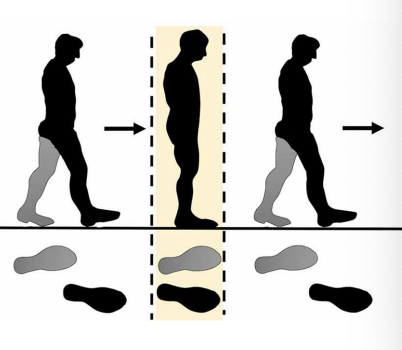 <p>Uneven Step Length </p>