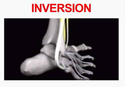 <p>Inversion</p>