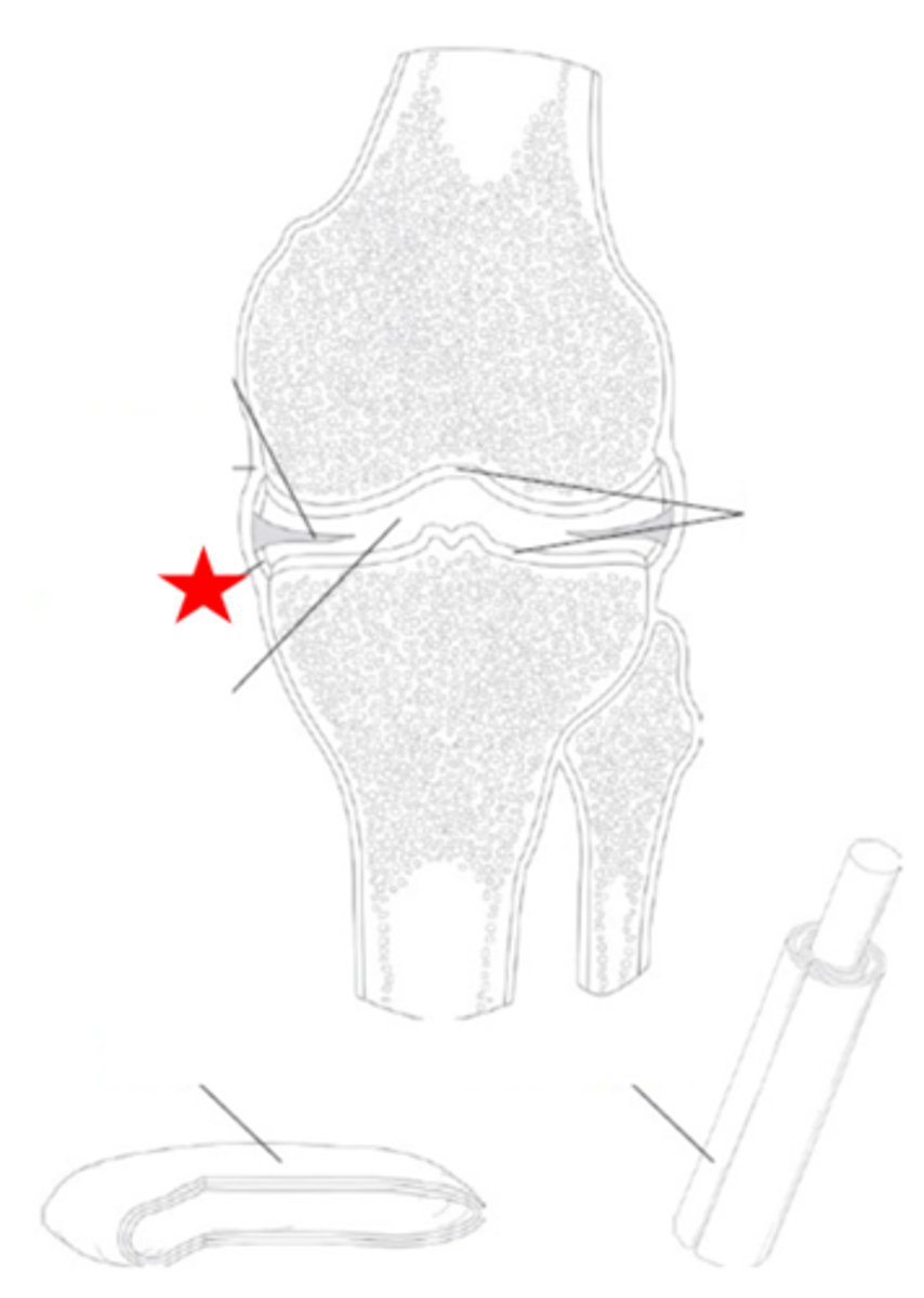 <p>Identify the synovial joint structure that the star is pointing to.</p>