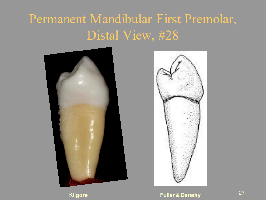 <p>Permanent Mandibular First Premolar, Distal View, #28</p>