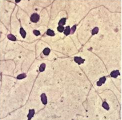 <p>Identify the sperm morphology.</p>