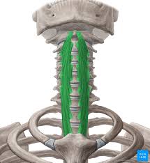 <p>Action: Flexion <strong>of the cervical</strong></p><p>Exercise: Chin tucks</p><p>Stretch: Neck extension</p>
