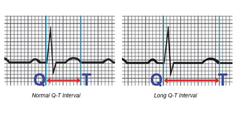 <p>What does this refer to</p><ul><li><p>QTi often measured in Lead II of a 12 Lead</p></li><li><p>Measured from onset of Q to end of T wave</p></li><li><p>QT varies inversely with heart rate, therefore a corrected QT (QTc) is obtained </p></li><li><p>Qtc &gt; 0.44 in men considered prolonged</p></li><li><p>Qtc &gt; 0.47 in women considered prolonged (normal 0.45-0.47)</p></li><li><p>&gt; 0.50 considered highly abnormal (increasing danger)</p></li></ul><p></p>