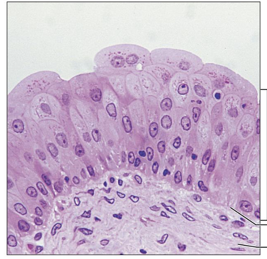 <p>What is this tissue, and where is it found?</p>