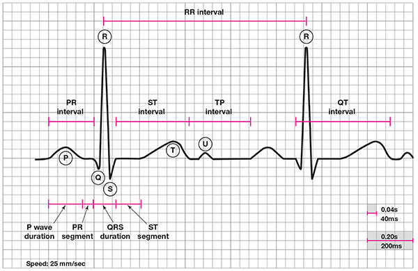 <p>How to calculate HR in bpm using ECG?</p>