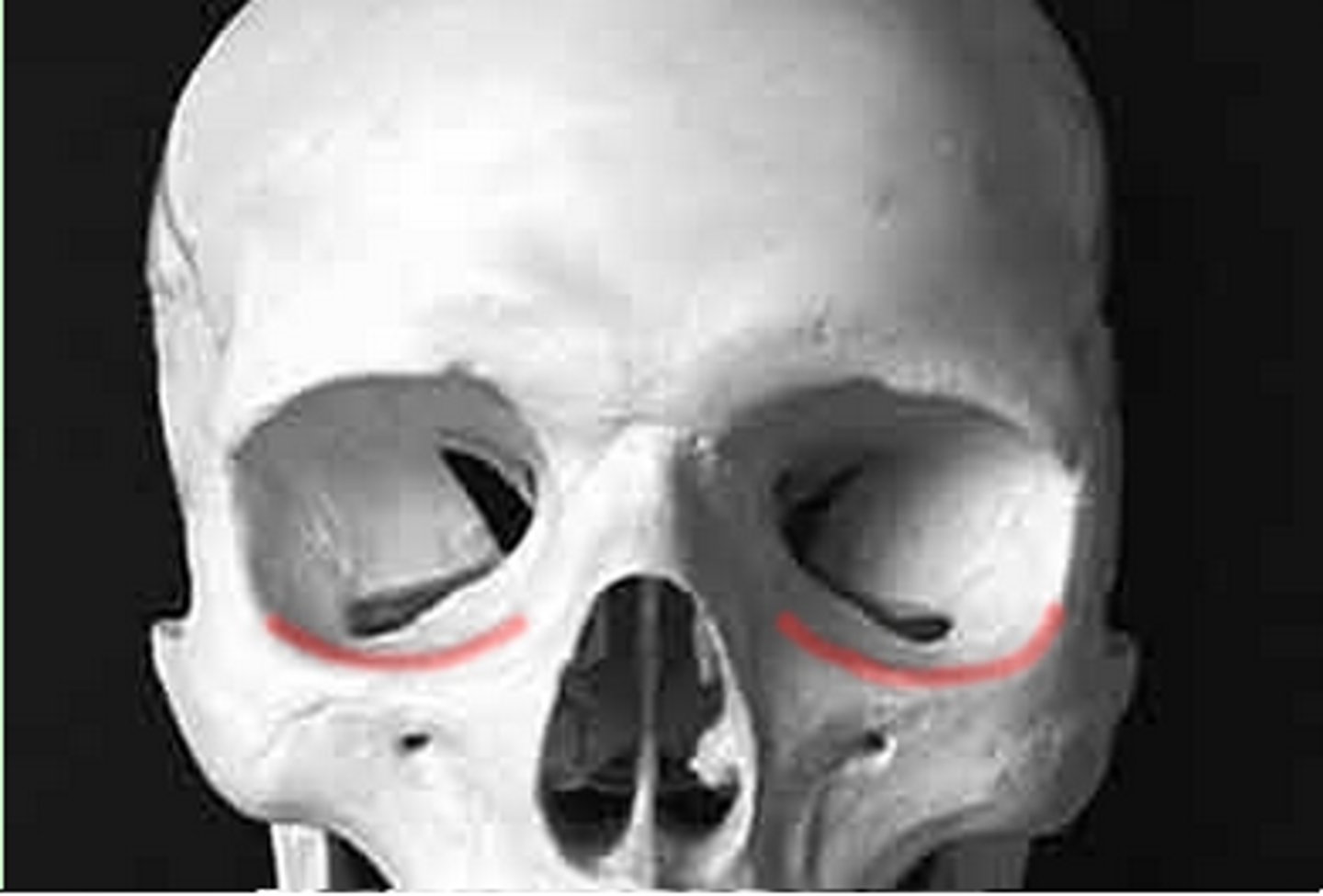 <p>What is shown on the image?</p>