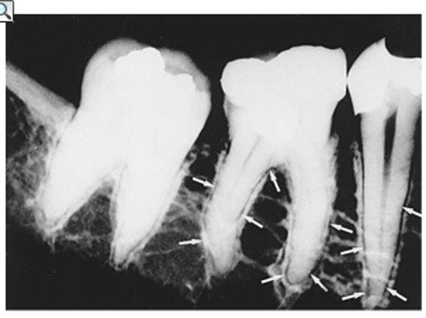 <p>What is the radiolucent structure seen here?</p>