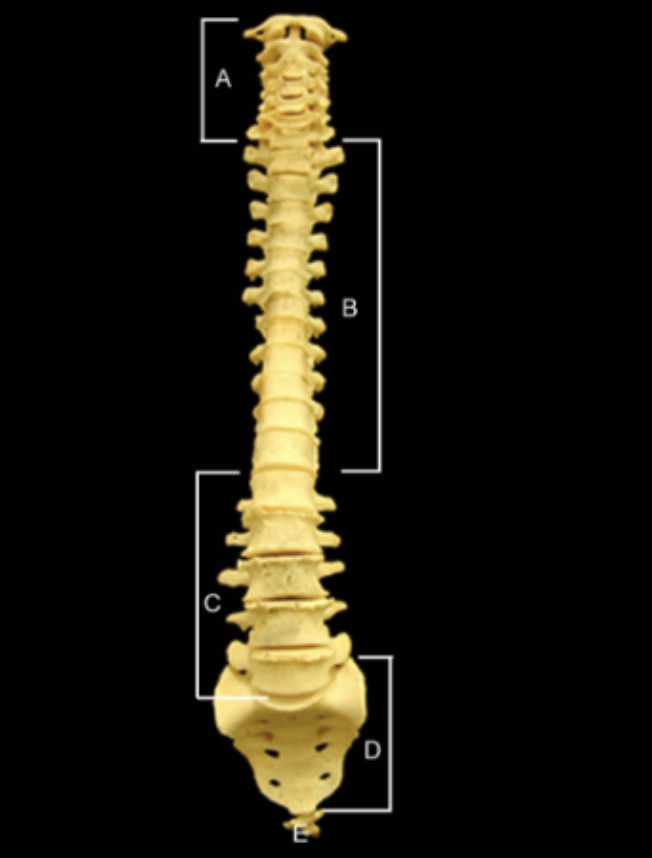 <p>Identify the regions of the vertebral column</p>