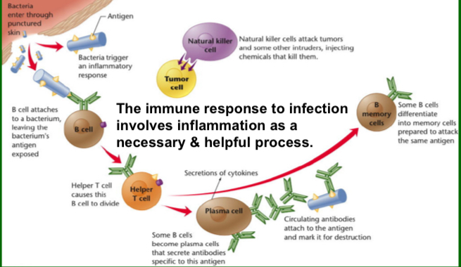 <ul><li><p>The immune response to infection involves inflammation as a necessary &amp; helpful process </p></li><li><p>Ex:</p></li></ul>