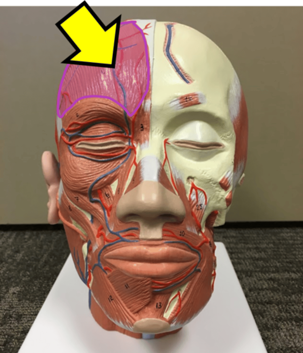 <p>Name just this part of the muscle</p>