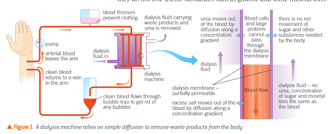 <ul><li><p>Blood leaves patient’s body from artery &amp; flows in thru partially permeable dialysis membranes</p><ul><li><p>Mimics basement membrane of B.C.</p></li></ul></li><li><p>Contains normal plasma levels of glucose &amp; mineral ions so no net movement of g out of blood </p><ul><li><p>Excess mineral ions move down conc. g by diffusion</p></li></ul></li><li><p>Contains no urea</p><ul><li><p>Steep conc. gradient, much leaves blood</p></li></ul></li><li><p>Blood &amp; dialysis flow in opp. directions to maintain counter current exchange system &amp; maximise exchange</p></li></ul><p></p>