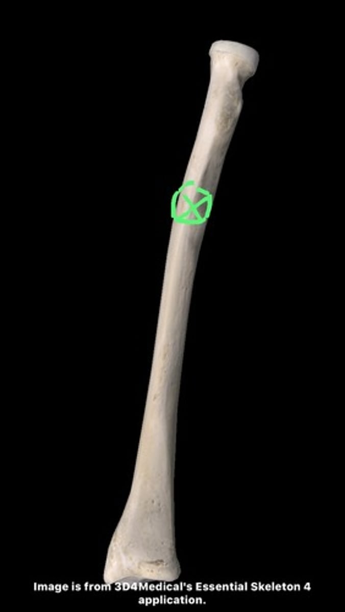 <p>anterior </p>
