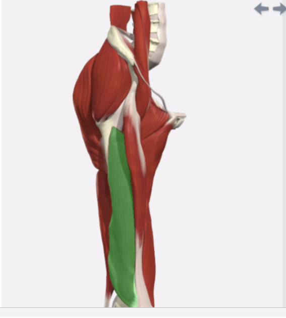 <p>Vastus Intermedius</p>
