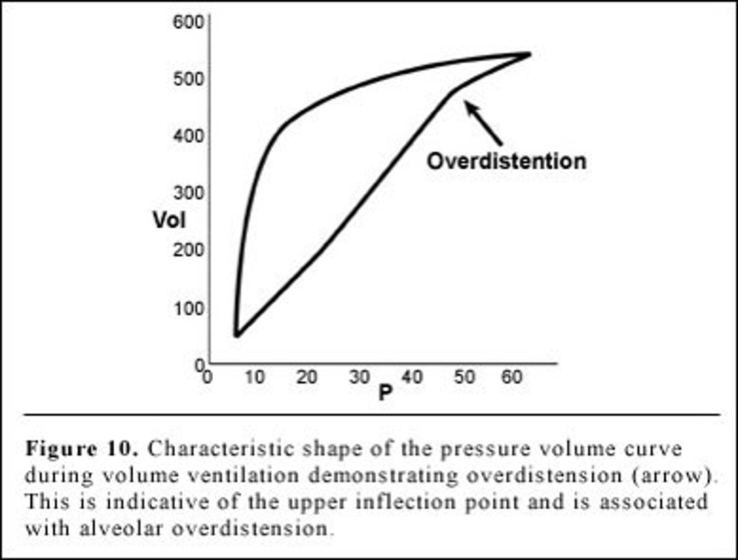 <p>​​"Beaking" at the upper inflection point, indicating excessive tidal volume or high pressure.</p>