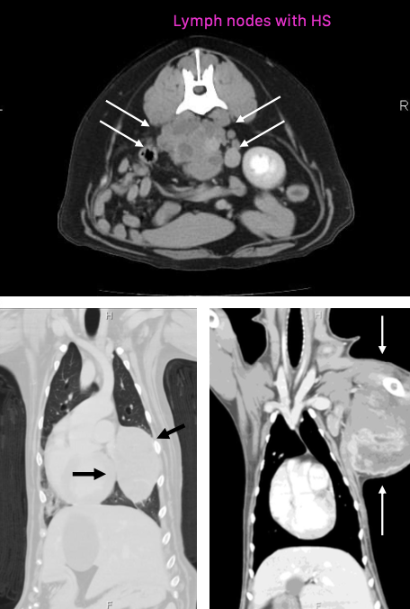 <p>may be localized or disseminated:</p><p>1. localized histiocytic sarcoma</p><p>2. disseminated histiocytic sarcoma</p><p>3. hemophagocytic histiocytic sarcoma</p>