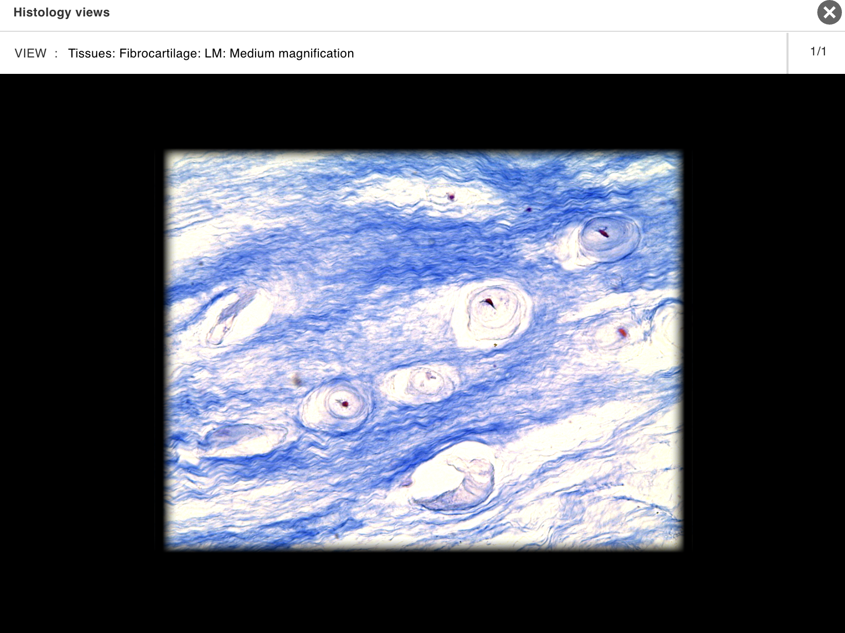 <p>Pubic symphysis</p>