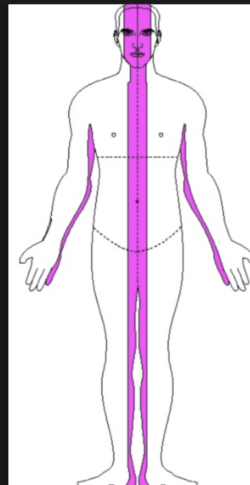 <p>Region 1</p><p>-frontal headache, eye disorders, nasal obstruction, trigeminal neuralgia, frontal toothache, pharyngitis, tracheitis, stomachache, dysmenoorrhea, excessive leukorrhea, noctural enuresis, thick tongue coat </p>