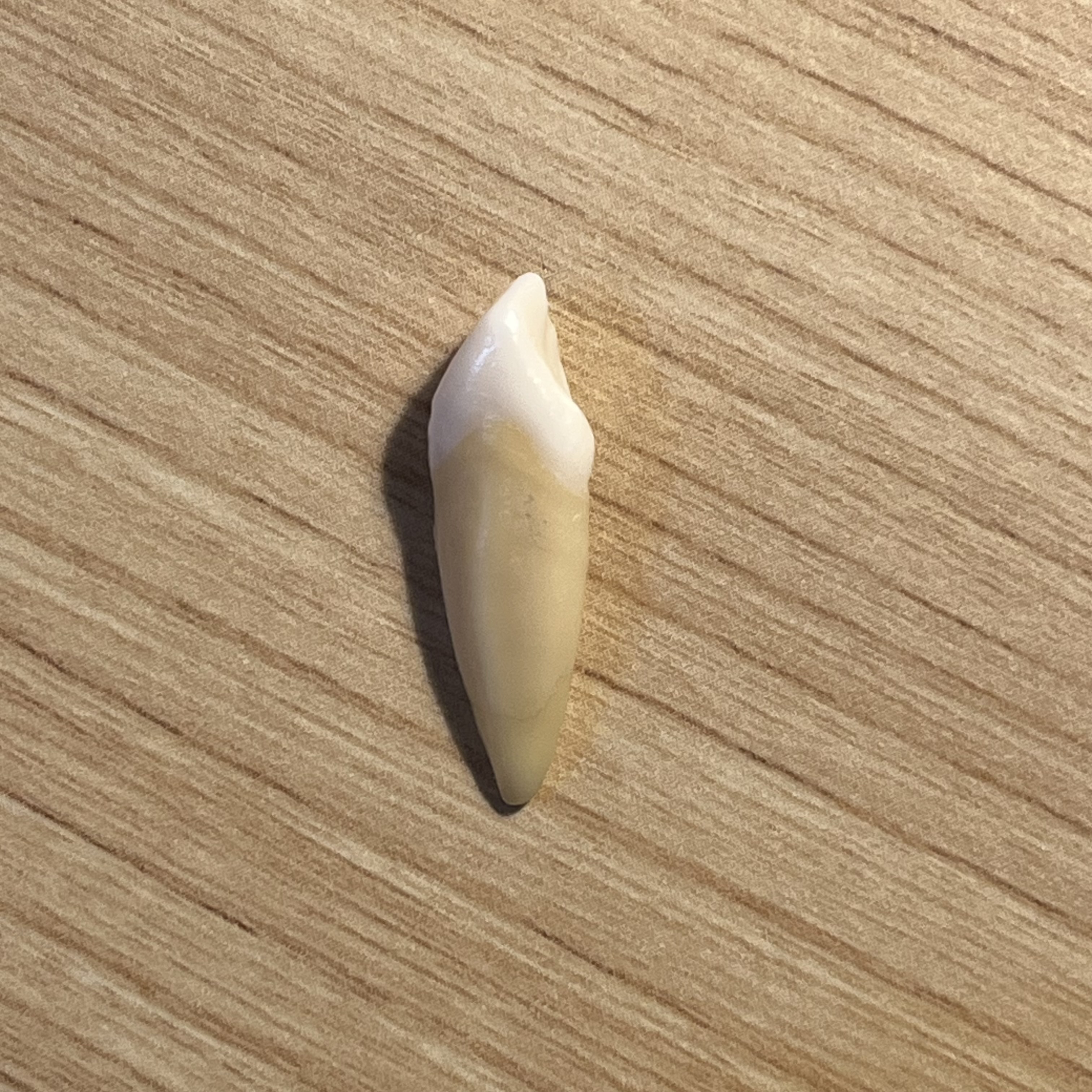 <p>What tooth is this (with view)?</p>