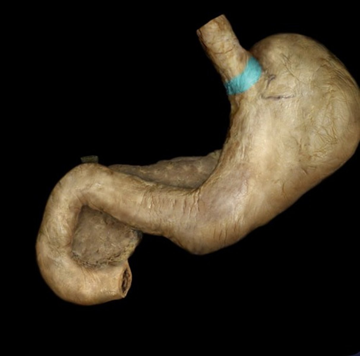 knowt flashcard image