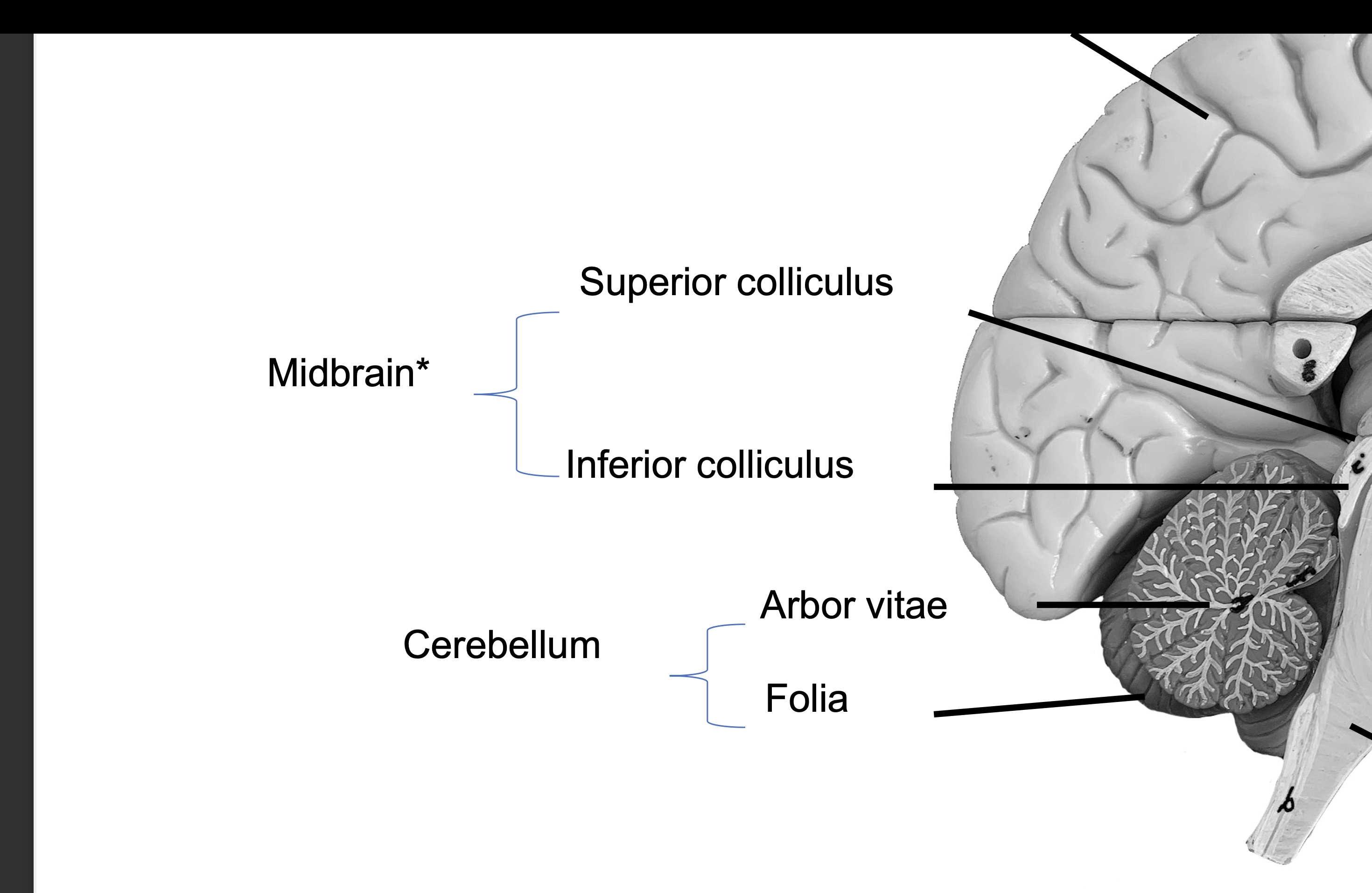 <p>Inferior colliculus (Midbrain)</p>