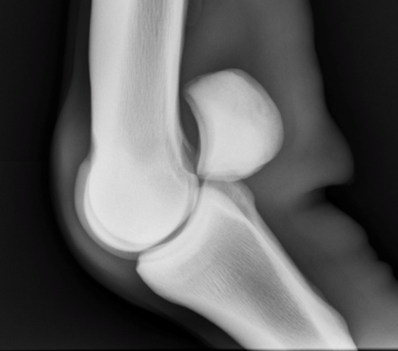 <p>What is highlighted in the flexed LM view of the fetlock?</p>