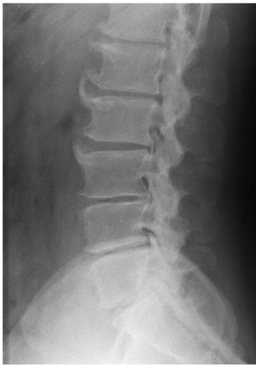 <p>What diagnosis is this?</p>