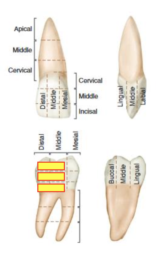 term image