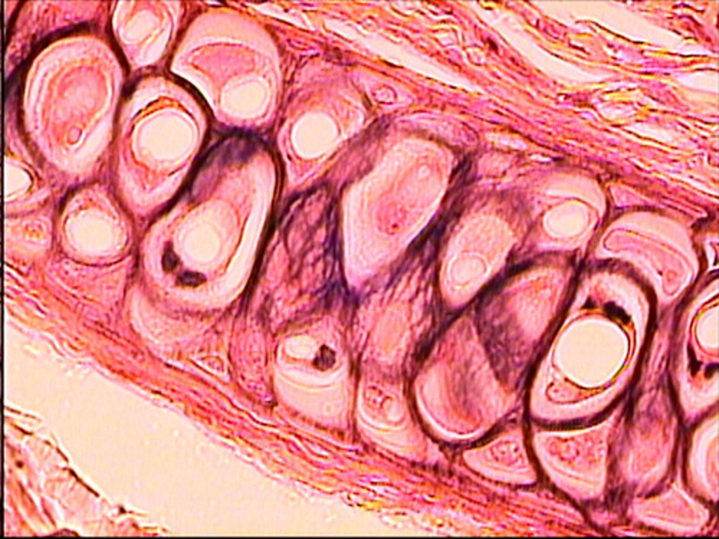<p>cell has chondrocytes in lacuna but also has fibers in matrix</p><p>found in pinna, epigottis, thyroid cart (located above gland)</p>
